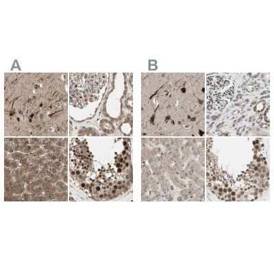 <b>Independent Antibodies Validation. </b>Immunohistochemistry-Paraffin: MLF2 Antibody [NBP1-82519] - Staining of human cerebral cortex, kidney, liver and testis using Anti-MLF2 antibody NBP1-82519 (A) shows similar protein distribution across tissues to independent antibody NBP1-82518 (B).