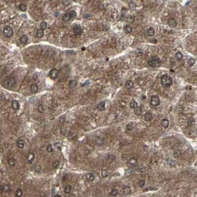 Immunohistochemistry-Paraffin: MLF2 Antibody [NBP1-82519] - Staining of human liver.