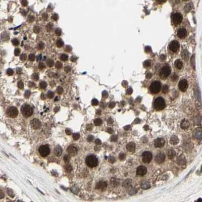 Immunohistochemistry-Paraffin: MLF2 Antibody [NBP1-82519] - Staining of human testis.