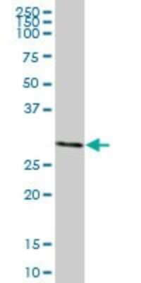 Western Blot: MLF2 Antibody [H00008079-B01P] - Analysis of MLF2 expression in human liver.