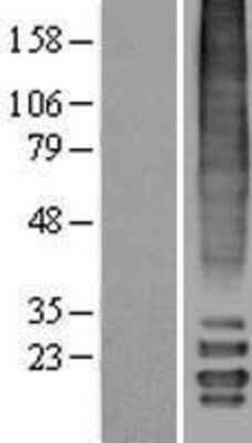 Western Blot: MLF2 Overexpression Lysate (Adult Normal) [NBL1-13133] Left-Empty vector transfected control cell lysate (HEK293 cell lysate); Right -Over-expression Lysate for MLF2.