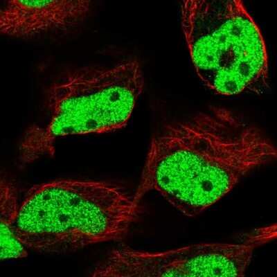 Immunocytochemistry/Immunofluorescence: MLH1 Antibody [NBP2-56287] - Staining of human cell line RH-30 shows localization to nucleoplasm.