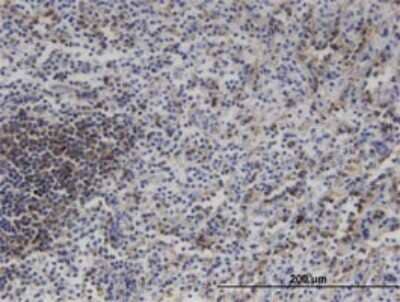 Immunohistochemistry-Paraffin: MLK3 Antibody (3D11) [H00004296-M02] - Analysis of monoclonal antibody to MAP3K11 on formalin-fixed paraffin-embedded human spleen. Antibody concentration 3 ug/ml.