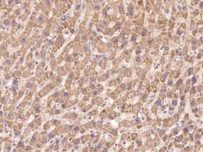 Immunohistochemistry: MLK3 Antibody [NBP3-06619] - Immunohistochemical staining of human MLK3 in human liver with NBP3-06619 at 1:100 dilution, formalin-fixed paraffin embedded sections.