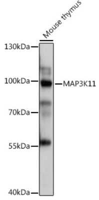 Western Blot: MLK3 Antibody [NBP3-03475] - Western blot analysis of extracts of Mouse thymus, using MLK3 antibody (NBP3-03475) at 1:1000 dilution. Secondary antibody: HRP Goat Anti-Rabbit IgG (H+L) at 1:10000 dilution. Lysates/proteins: 25ug per lane. Blocking buffer: 3% nonfat dry milk in TBST. Detection: ECL Basic Kit. Exposure time: 1s.