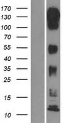 Western Blot: MLK3 Overexpression Lysate (Adult Normal) [NBP2-10830] Left-Empty vector transfected control cell lysate (HEK293 cell lysate); Right -Over-expression Lysate for MLK3.