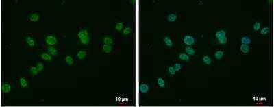 Immunocytochemistry/Immunofluorescence: MLLT6 Antibody [NBP2-17307] -  A375 cells were fixed in 4% paraformaldehyde at RT for 15 min. Green: MLLT6 protein stained by MLLT6 antibody  diluted at 1:500. Blue: Hoechst 33342 staining. Scale bar = 10 um.