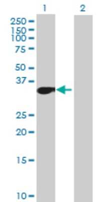 Western Blot: MLLT6 Antibody [H00004302-B01P] - Analysis of MLLT6 expression in transfected 293T cell line by MLLT6 polyclonal antibody.  Lane 1: MLLT6 transfected lysate(35.75 KDa). Lane 2: Non-transfected lysate.