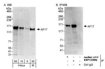 Western Blot: MLLT6 Antibody [NBP1-22995] - AF17 by Western Blot (h&m) and Immunoprecipitation (h). Samples: Whole cell lysate from HeLa (5, 15 and 50 mcg for WB; 1 mg for IP, 20% of IP loaded) and mouse NIH3T3 (M; 50 mcg) cells. Antibodies: Affinity purified rabbit anti-AF17 antibody A302-198A used for WB at 0.1 mcg/ml (A) and 1 mcg/ml (B) and used for IP at 3 mcg/mg lysate. AF17 was also immunoprecipitated by rabbit anti-AF17 antibody BL8668, which recognizes an upstream epitope.