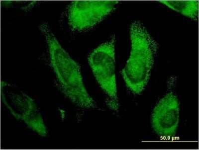 Immunocytochemistry/Immunofluorescence: MLX Antibody (1C3) [H00006945-M07] - Analysis of monoclonal antibody to MLX on HeLa cell. Antibody concentration 10 ug/ml