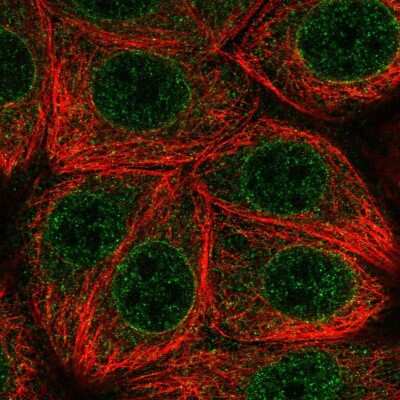 Immunocytochemistry/Immunofluorescence: MLX Antibody [NBP2-55725] - Staining of human cell line MCF7 shows localization to nucleoplasm, nuclear membrane & cytosol. Antibody staining is shown in green.