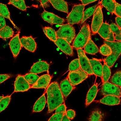 Immunocytochemistry/Immunofluorescence: MLX Antibody (PCRP-MLX-1G8) [NBP3-08241] - Immunofluorescence Analysis of PFA-fixed HeLa cells. MLX Mouse Monoclonal Antibody (PCRP-MLX-1G8) followed by goat anti- Mouse IgG-CF488 (green); counterstain phalloidin (red).