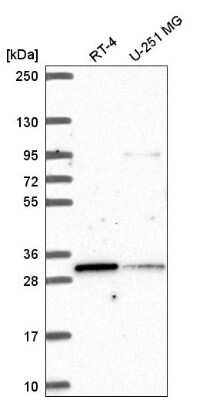 Western Blot: MLX Antibody [NBP2-55725] - Analysis in human cell line RT-4 and human cell line U-251 MG.