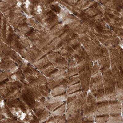 Immunohistochemistry: MLXIP Antibody [NBP1-88617] - Staining of human skeletal muscle shows strong cytoplasmic positivity.