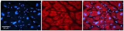 Immunohistochemistry-Paraffin: MLXIP Antibody [NBP2-85298] - Rabbit Anti-MLXIP Antibody. Formalin Fixed Paraffin Embedded Tissue: Human Adult heart. Observed Staining: Cytoplasmic. Primary Antibody Concentration: 1:600. Secondary Antibody: Donkey anti-Rabbit-Cy2/3. Secondary Antibody Concentration: 1:200. Magnification: 20X.