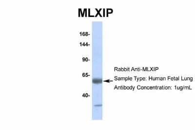 Western Blot: MLXIP Antibody [NBP2-85297] - Host: Rabbit. Target Name: MLXIP. Sample Type: Human Fetal Lung. Antibody Dilution: 1.0ug/ml