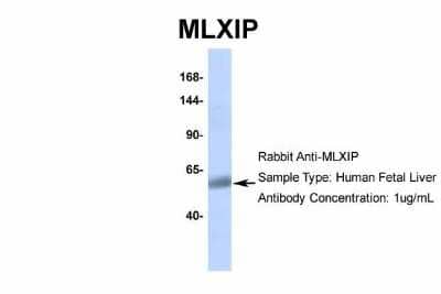 Western Blot: MLXIP Antibody [NBP2-85297] - Host: Rabbit. Target Name: MLXIP. Sample Type: Human Fetal Liver. Antibody Dilution: 1.0ug/ml