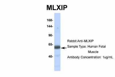 Western Blot: MLXIP Antibody [NBP2-85297] - Host: Rabbit. Target Name: MLXIP. Sample Type: Human Fetal Muscle. Antibody Dilution: 1.0ug/ml