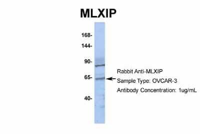 Western Blot: MLXIP Antibody [NBP2-85297] - Host: Rabbit. Target Name: MLXIP. Sample Type: OVCAR-3. Antibody Dilution: 1.0ug/mlMLXIP is supported by BioGPS gene expression data to be expressed in OVCAR3