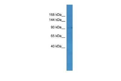 Western Blot: MLXIP Antibody [NBP2-85298] - WB Suggested Anti-MLXIP Antibody Titration: 0.2-1 ug/ml. ELISA Titer: 1:62500. Positive Control: Jurkat cell lysateMLXIP is strongly supported by BioGPS gene expression data to be expressed in Human Jurkat cells