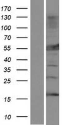 Western Blot: MLYCD Overexpression Lysate (Adult Normal) [NBP2-07475] Left-Empty vector transfected control cell lysate (HEK293 cell lysate); Right -Over-expression Lysate for MLYCD.