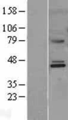 Western Blot: MMAA Overexpression Lysate (Adult Normal) [NBL1-13142] Left-Empty vector transfected control cell lysate (HEK293 cell lysate); Right -Over-expression Lysate for MMAA.