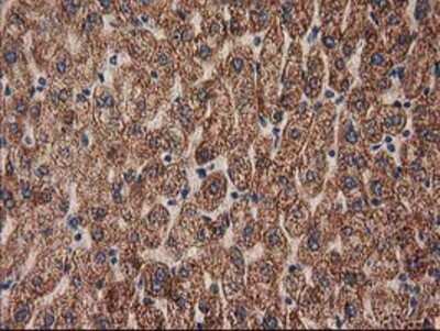 Immunohistochemistry-Paraffin: MMAB Antibody (2G5) [NBP2-03417] - Staining of paraffin-embedded Human liver tissue using anti-MMAB mouse monoclonal antibody.