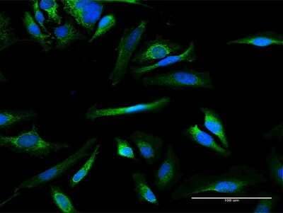 Immunocytochemistry/Immunofluorescence: MMAB Antibody [H00326625-B02P] - Analysis of purified antibody to MMAB on HeLa cell. (antibody concentration 10 ug/ml)