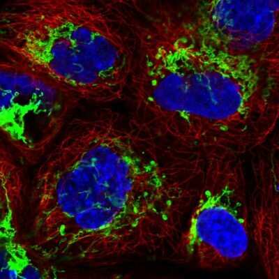 <b>Orthogonal Strategies Validation. </b>Immunocytochemistry/Immunofluorescence: MMAB Antibody [NBP1-86602] - Immunofluorescent staining of human cell line A-431 shows localization to mitochondria.