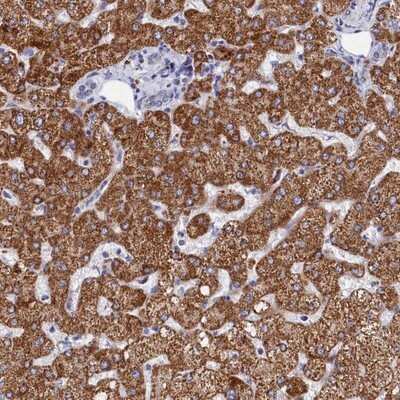 Immunohistochemistry-Paraffin: MMAB Antibody [NBP1-86602] - Staining of human liver shows strong granular cytoplasmic positivity in hepatocytes.