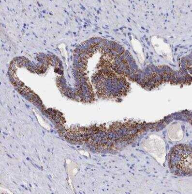 Immunohistochemistry-Paraffin: MMAB Antibody [NBP1-86602] - Staining of human prostate shows strong granular cytoplasmic psotivity in glandular cells.