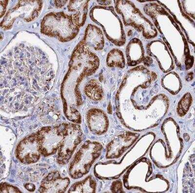 Immunohistochemistry-Paraffin: MMAB Antibody [NBP1-86602] - Staining of human kidney shows strong granular cytoplasmic positivity in cells in tubules.