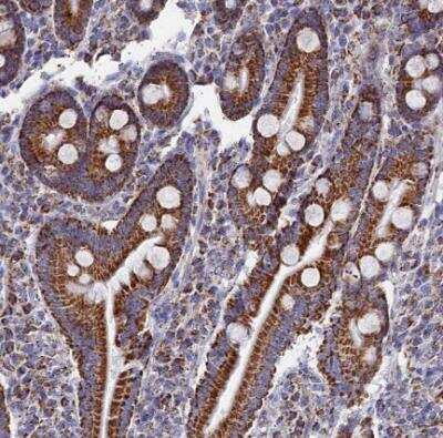 Immunohistochemistry-Paraffin: MMAB Antibody [NBP1-86602] - Staining of human duodenum shows strong granular cytoplasmic positivity in glandular cells.