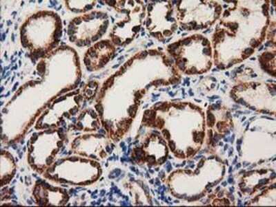 Immunohistochemistry: MMAB Antibody (OTI2G5) - Azide and BSA Free [NBP2-72730] - Staining of paraffin-embedded Human Kidney tissue using anti-MMAB mouse monoclonal antibody.