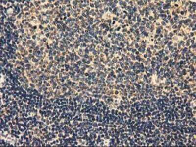 Immunohistochemistry: MMAB Antibody (OTI2G5) - Azide and BSA Free [NBP2-72730] - Staining of paraffin-embedded Human lymph node tissue using anti-MMAB mouse monoclonal antibody.