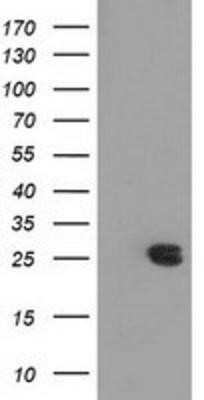 Western Blot: MMAB Antibody (OTI2G5) - Azide and BSA Free [NBP2-72730] - HEK293T cells were transfected with the pCMV6-ENTRY control (Left lane) or pCMV6-ENTRY MMAB (Right lane) cDNA for 48 hrs and lysed. Equivalent amounts of cell lysates (5 ug per lane) were separated by SDS-PAGE and immunoblotted with anti-MMAB.