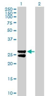 Western Blot: MMAB Antibody [H00326625-B02P] - Analysis of MMAB expression in transfected 293T cell line by MMAB polyclonal antibody.  Lane 1: MMAB transfected lysate(27.5 KDa). Lane 2: Non-transfected lysate.