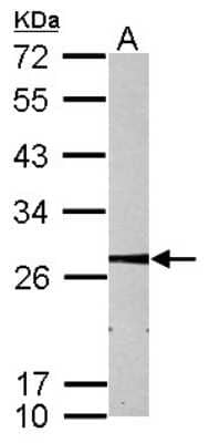 Western Blot: MMAB Antibody [NBP2-17308] - Sample (30 ug of whole cell lysate) A: HepG2 12% SDS PAGE gel, diluted at 1:1000.