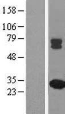 Western Blot MMAB Overexpression Lysate