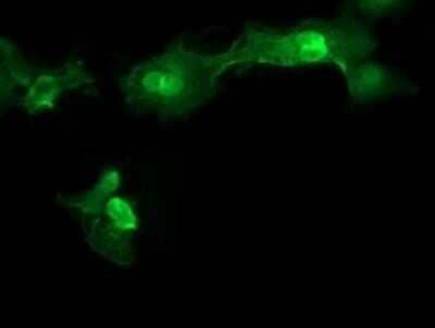 Immunocytochemistry/Immunofluorescence: MMACHC Antibody (OTI1A4) - Azide and BSA Free [NBP2-72738] - Analysis of COS7 cells transiently transfected by pCMV6-ENTRY MMACHC.