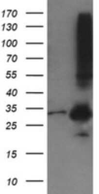 Western Blot: MMACHC Antibody (OTI1A4) - Azide and BSA Free [NBP2-72738] - HEK293T cells were transfected with the pCMV6-ENTRY control (Left lane) or pCMV6-ENTRY MMACHC cDNA for 48 hrs and lysed. Equivalent amounts of cell lysates (5 ug per lane) were separated by SDS-PAGE and immunoblotted with anti-MMACHC.