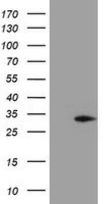 Western Blot: MMACHC Antibody (OTI4E9) - Azide and BSA Free [NBP2-72734] - HEK293T cells were transfected with the pCMV6-ENTRY control (Left lane) or pCMV6-ENTRY MMACHC (Right lane) cDNA for 48 hrs and lysed. Equivalent amounts of cell lysates (5 ug per lane) were separated by SDS-PAGE and immunoblotted with anti-MMACHC.