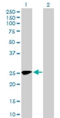 Western Blot: MMACHC Antibody [H00025974-B01P] - Analysis of MMACHC expression in transfected 293T cell line by MMACHC polyclonal antibody.  Lane 1: MMACHC transfected lysate(24.75 KDa). Lane 2: Non-transfected lysate.
