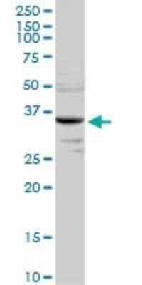 Western Blot: MMACHC Antibody [H00025974-D01P] - Analysis of MMACHC expression in human liver.