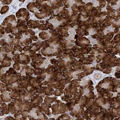 Immunohistochemistry-Paraffin: MMADHC Antibody [NBP1-86804] - Staining of human pancreas shows strong cytoplasmic positivity in exocrine glandular cells.