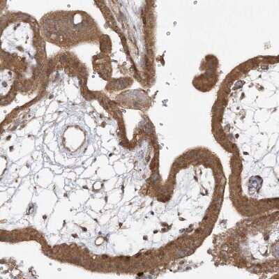 Immunohistochemistry-Paraffin: MMADHC Antibody [NBP2-38351] - Staining of human placenta shows moderate cytoplasmic positivity in trophoblastic cells.