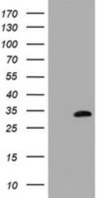 Western Blot: MMADHC Antibody (OTI1G4) - Azide and BSA Free [NBP2-72739] - Analysis of HEK293T cells were transfected with the pCMV6-ENTRY control (Left lane) or pCMV6-ENTRY MMADHC.
