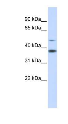 Western Blot: MMADHC Antibody [NBP1-54708] - Human Muscle lysate, concentration 0.2-1 ug/ml.