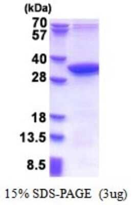 SDS-Page: Recombinant Human MMADHC Protein [NBP2-51545] - 15% SDS Page (3 ug)