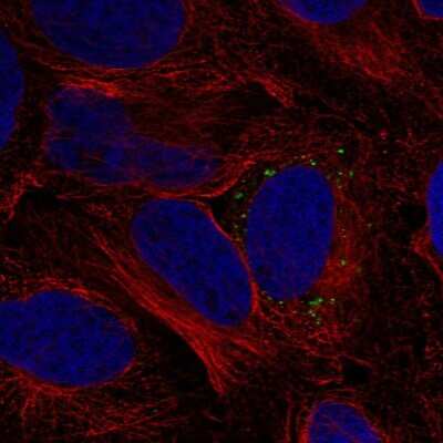 Immunocytochemistry/Immunofluorescence: MMD Antibody [NBP2-55515] - Staining of human cell line U-2 OS shows localization to vesicles.